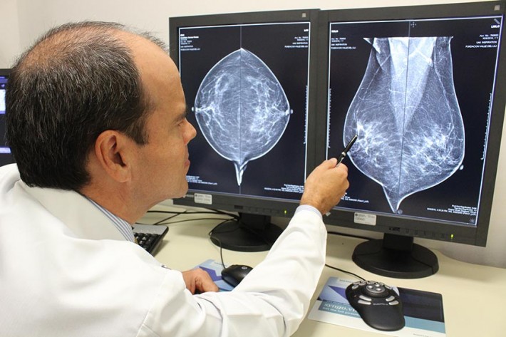 Foto-1-La-mamografia-digital-tiene-una-mejor-sensibilidad-para-deteccion-lesiones-sospechosas[1]