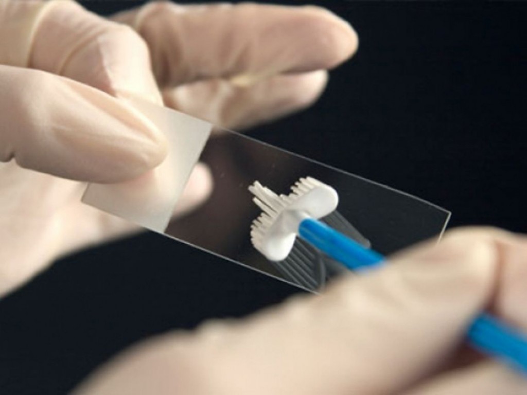 Papanicolaou Chequeos Ginecológicos Oncogyn