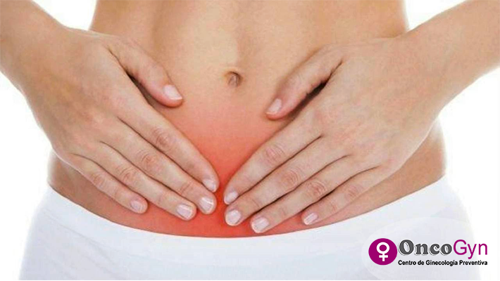 cáncer-de-cuello-uterino