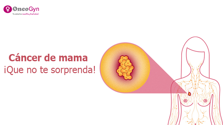 Cáncer de mama