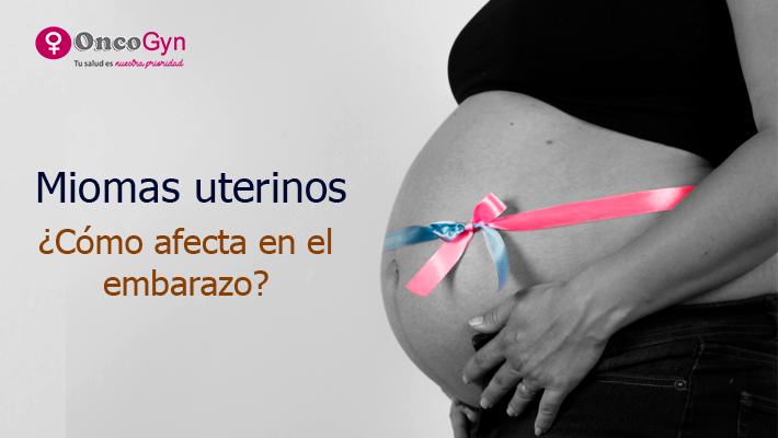 Miomas uterinos