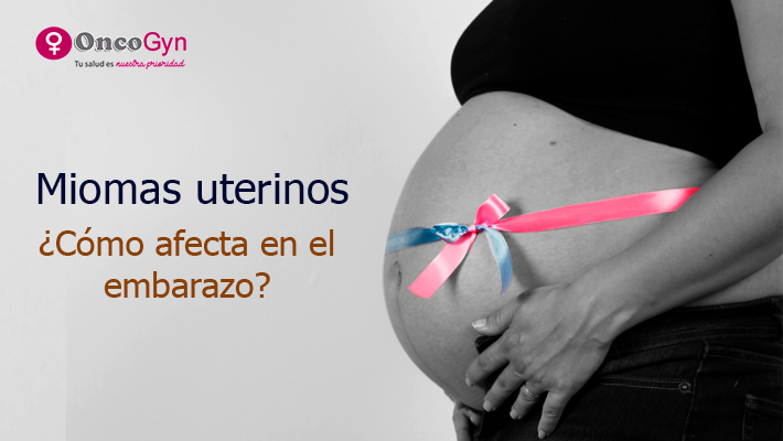 Miomas uterinos: ¿Cómo afecta en el embarazo?
