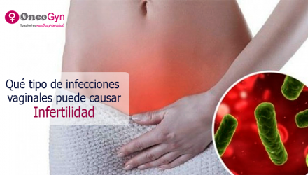 Infecciones Vaginales Oncogyn