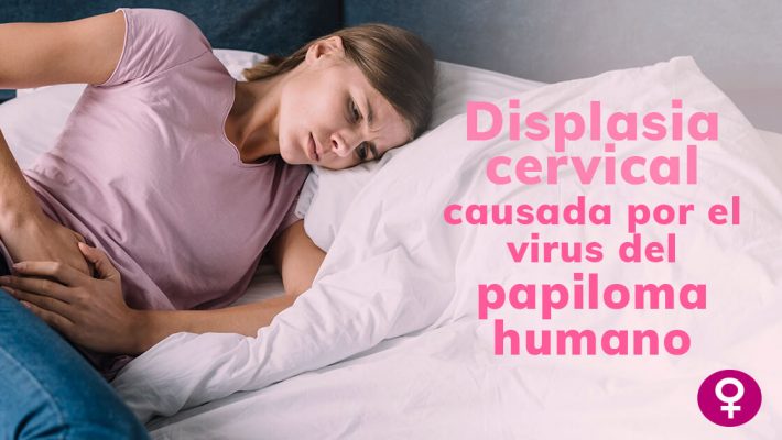 Displasia cervical causada por el virus del papiloma humano
