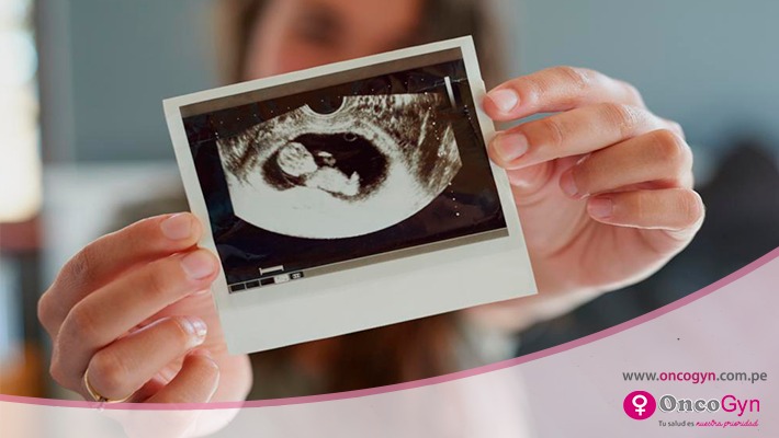 La ecografía genética y su importancia  en el primer trimestre de embarazo