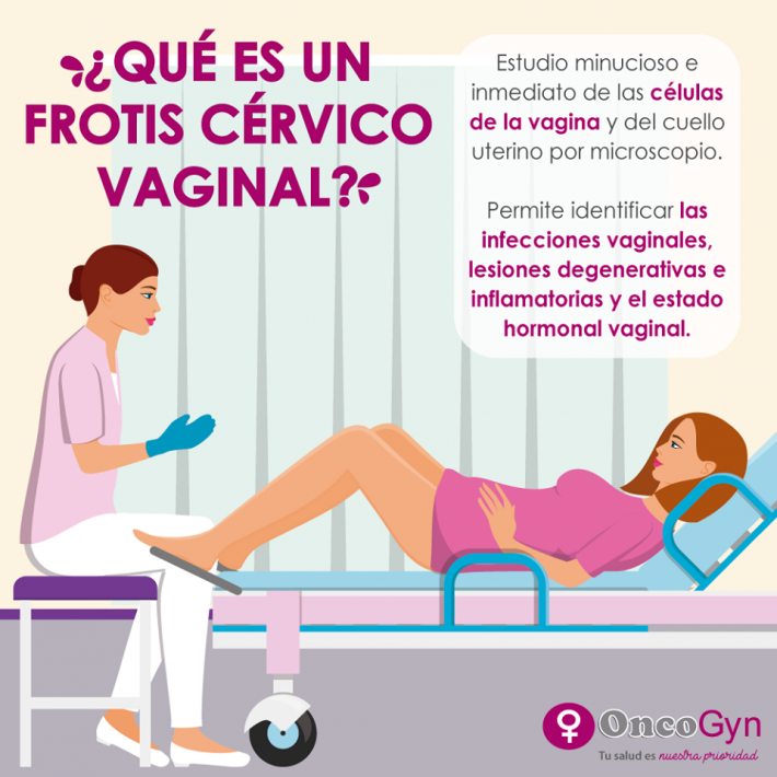 Frotis Cérvico Vaginal Chequeos Ginecológicos Oncogyn 6336