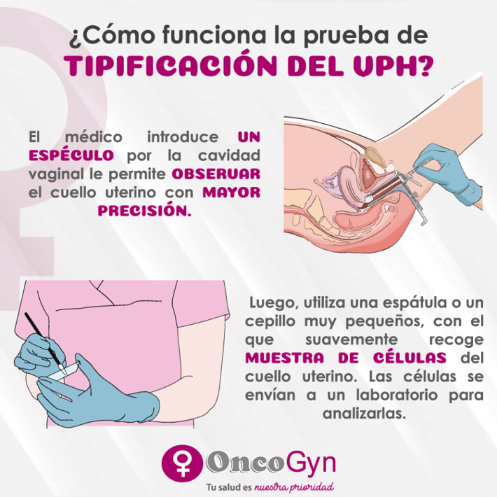 virus del papiloma humano tipificación