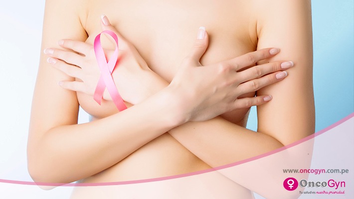 Senos densos como factor de riesgo para desarrollar cáncer de mama