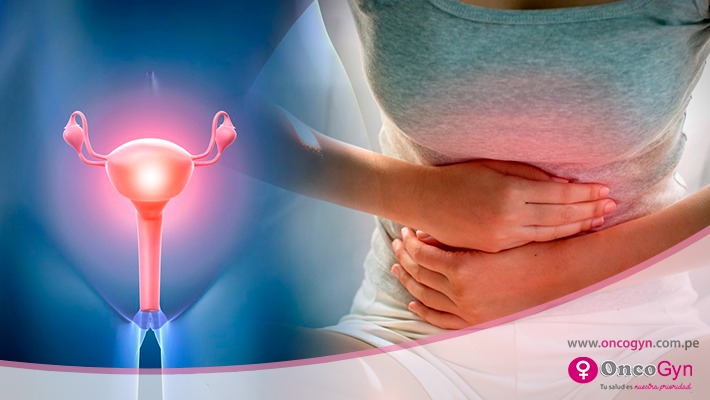 Prolapso de órganos pélvicos en mujeres, una enfermedad en aumento