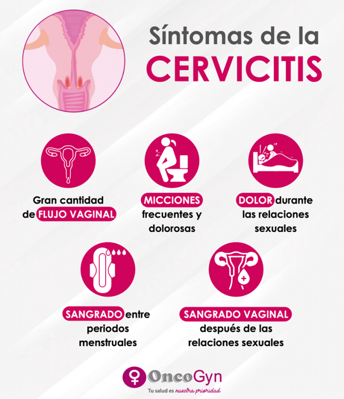 sintomas cervicitis