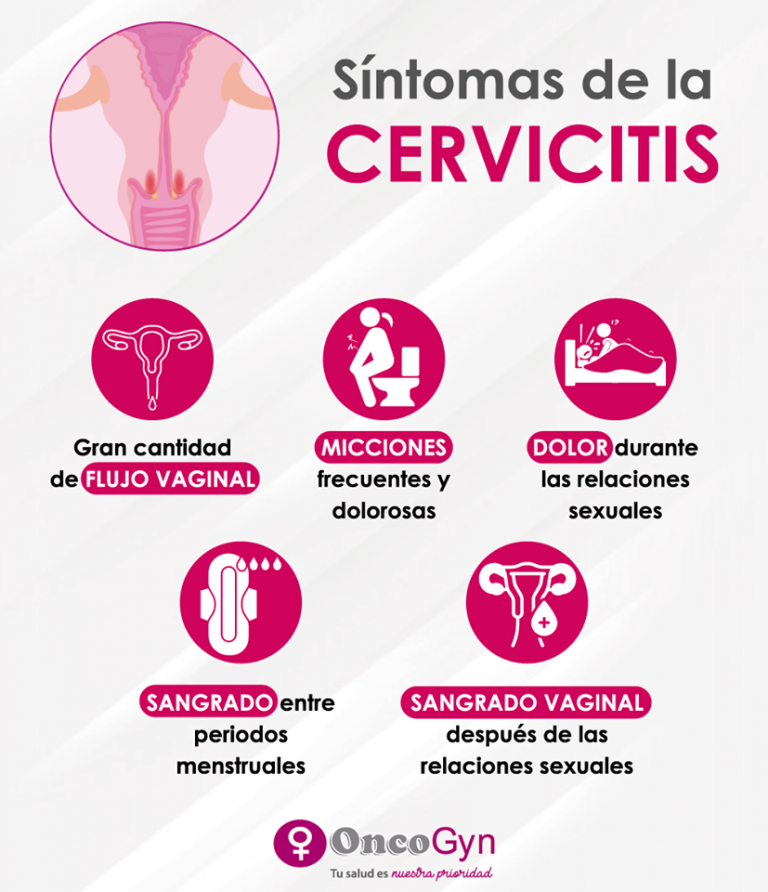Que Es Cervicitis Cronica Severa