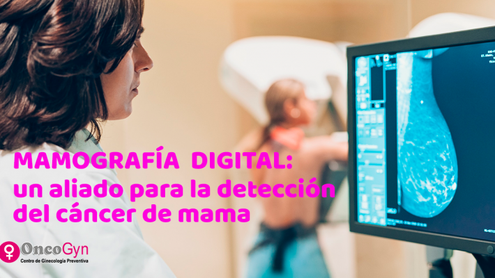 Mamografía digital: un aliado para la detección de cáncer de mama