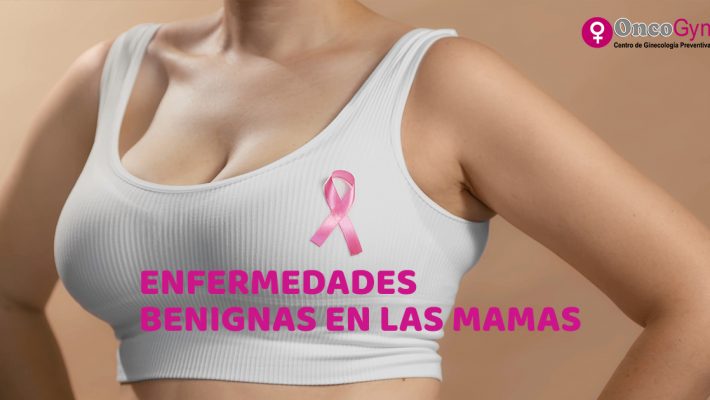 Enfermedades benignas en las mamas