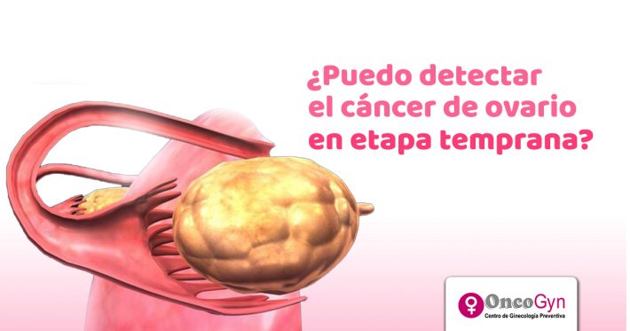 detectar cáncer de ovario1